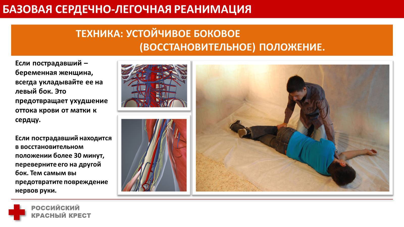 Боковое положение пострадавшего. Сердечно-лёгочная реанимация. Базовая сердечно-легочная реанимация. Положение пострадавшего при сердечно-легочной реанимации. Базисная сердечно-легочная реанимация.